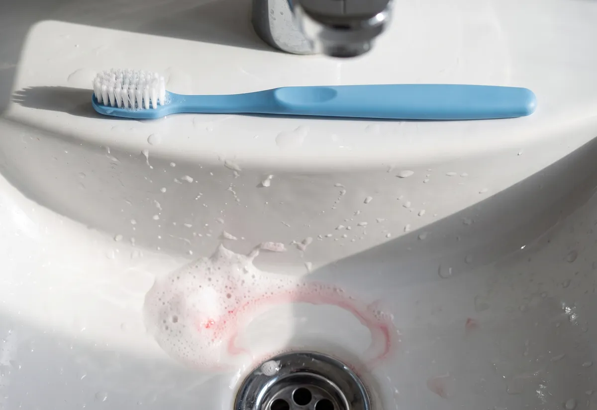 Toothache home remedies while you wait for the dentist