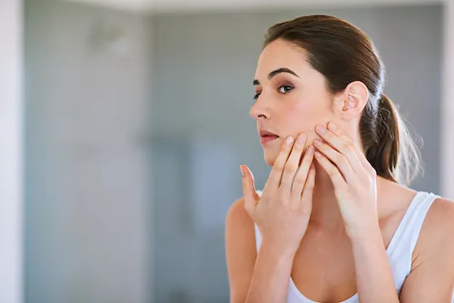 Acné : 3 solutions efficaces et naturelles