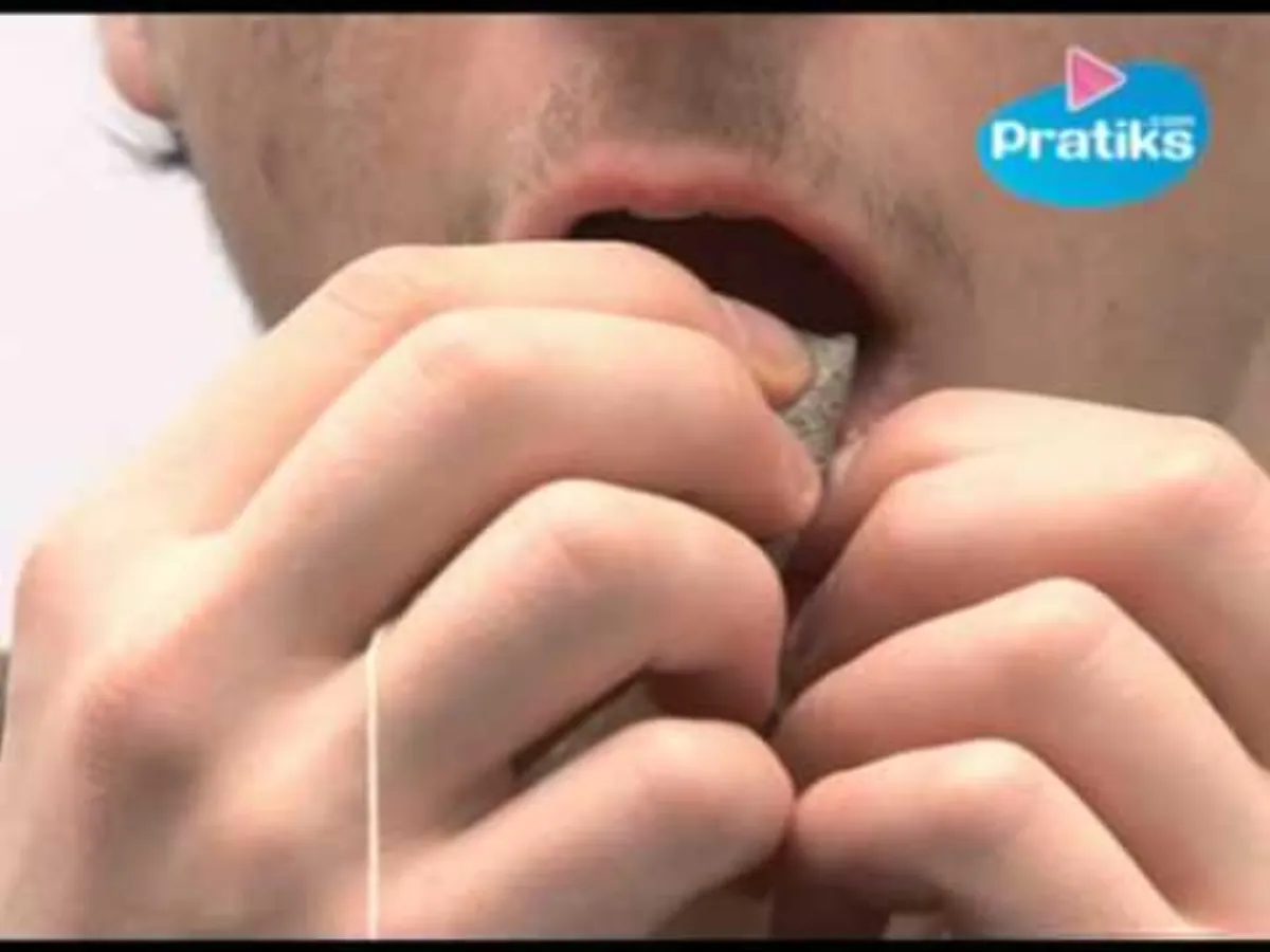 Aphte : 3 astuces pour s'en débarrasser