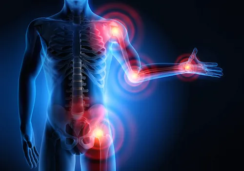 3 astuces de grands-mères pour soulager l'arthrose