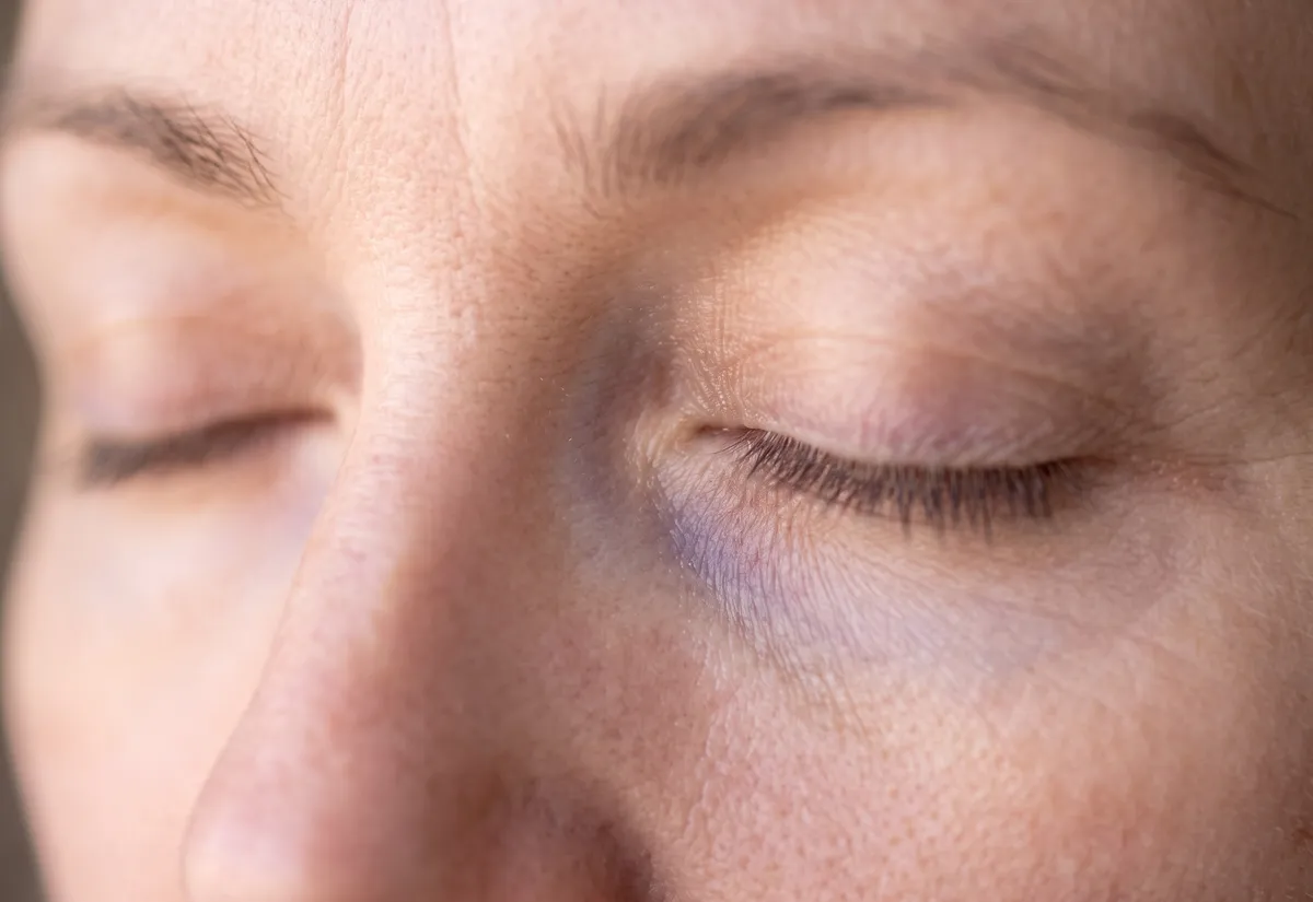 Cernes : 4 solutions naturelles