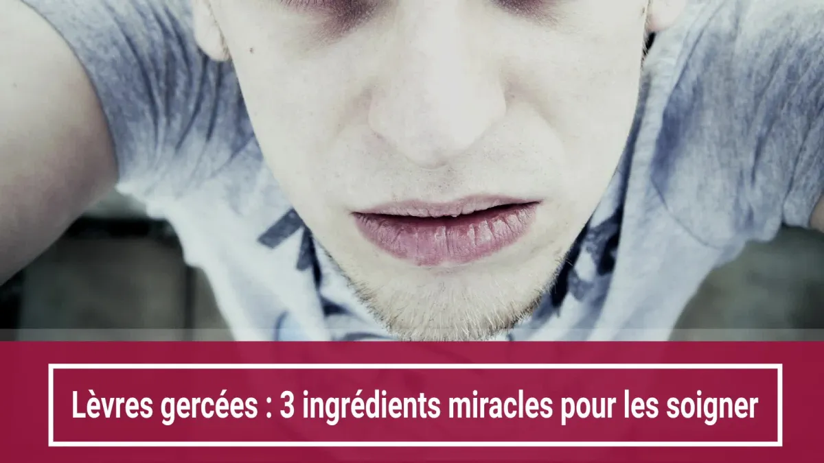 Lèvres gercées : 3 ingrédients miracles pour les soigner