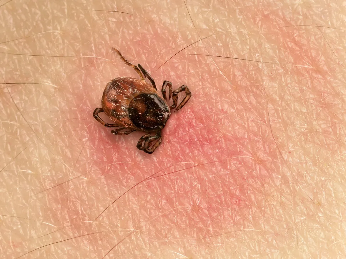 Que faire en cas de morsure de tique et comment prévenir la maladie de Lyme ?