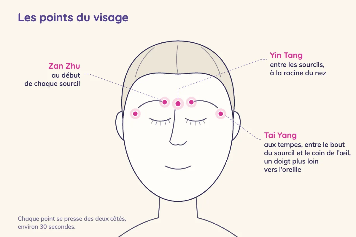 Schéma d'un visage de face, yeux fermés, montrant les points de pression contre le mal de tête : entre les sourcils à la racine du nez, au début de chaque sourcil, et aux tempes entre le bout du sourcil et le coin de l'œil, un doigt vers l'oreille
