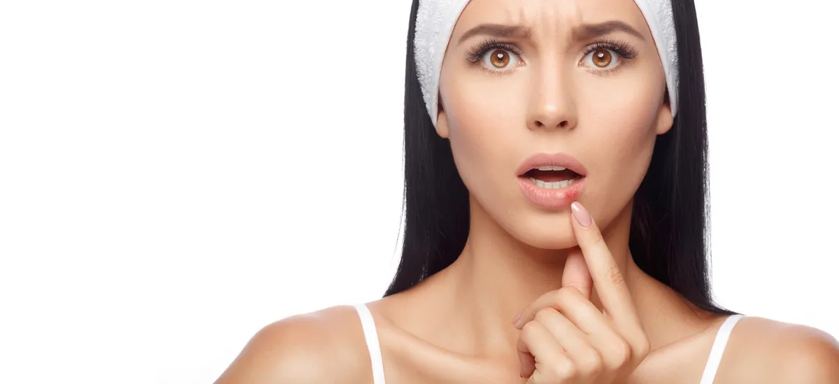Bouton de fièvre : symptômes et traitements