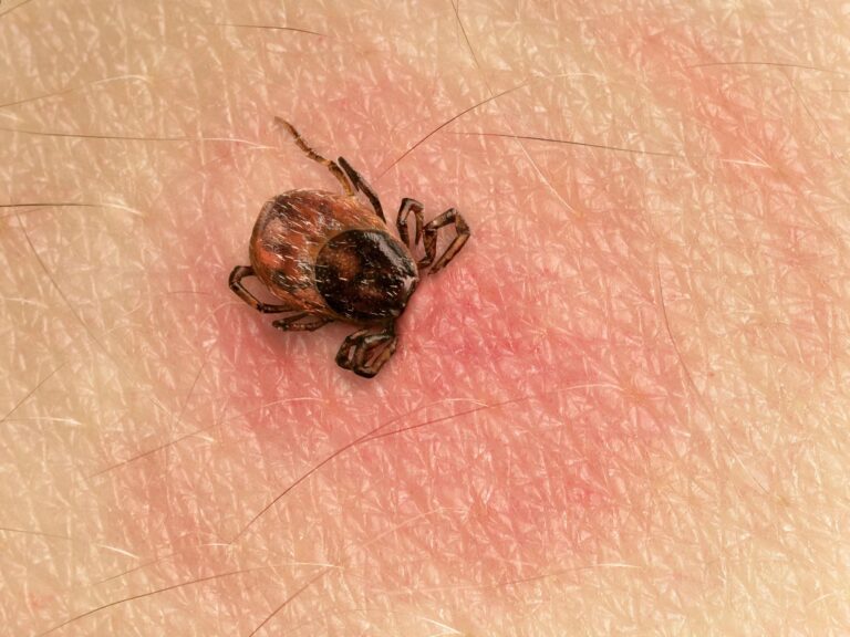 Que faire en cas de morsure de tique et comment prévenir la maladie de Lyme ?